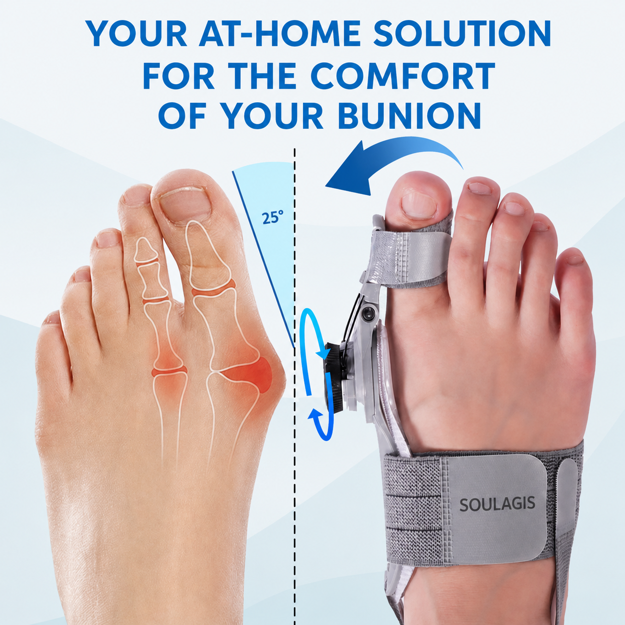 HalluxFlex by Soulagis – Hallux Valgus Corrector 2