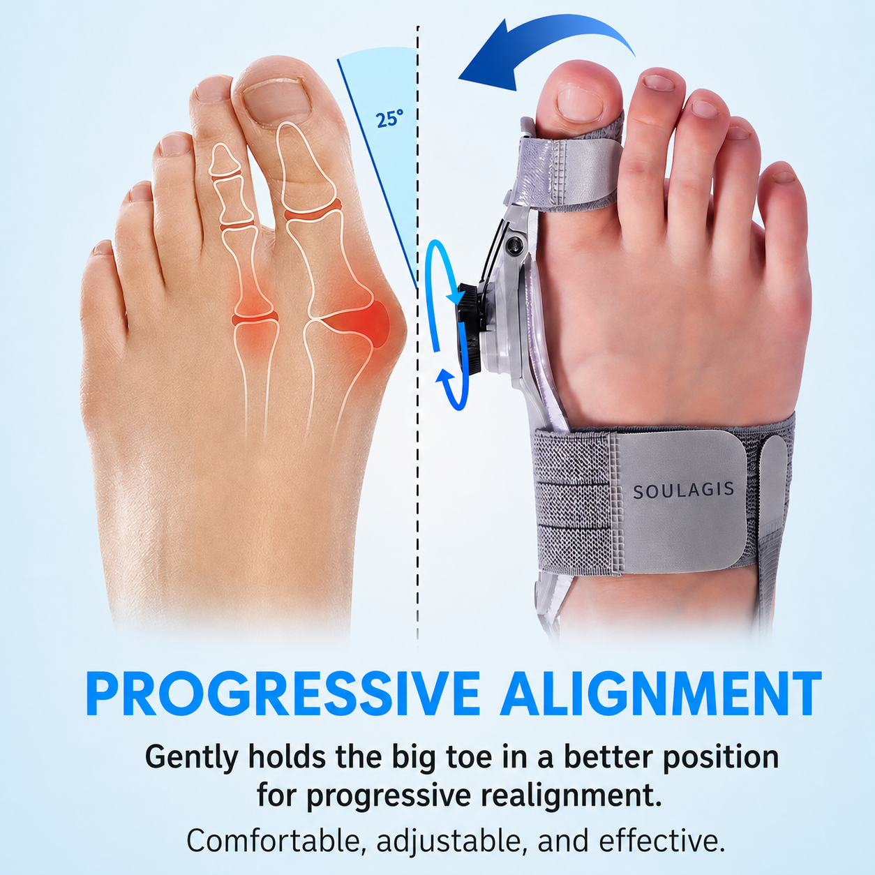 HalluxFlex by Soulagis – Hallux Valgus Corrector 2